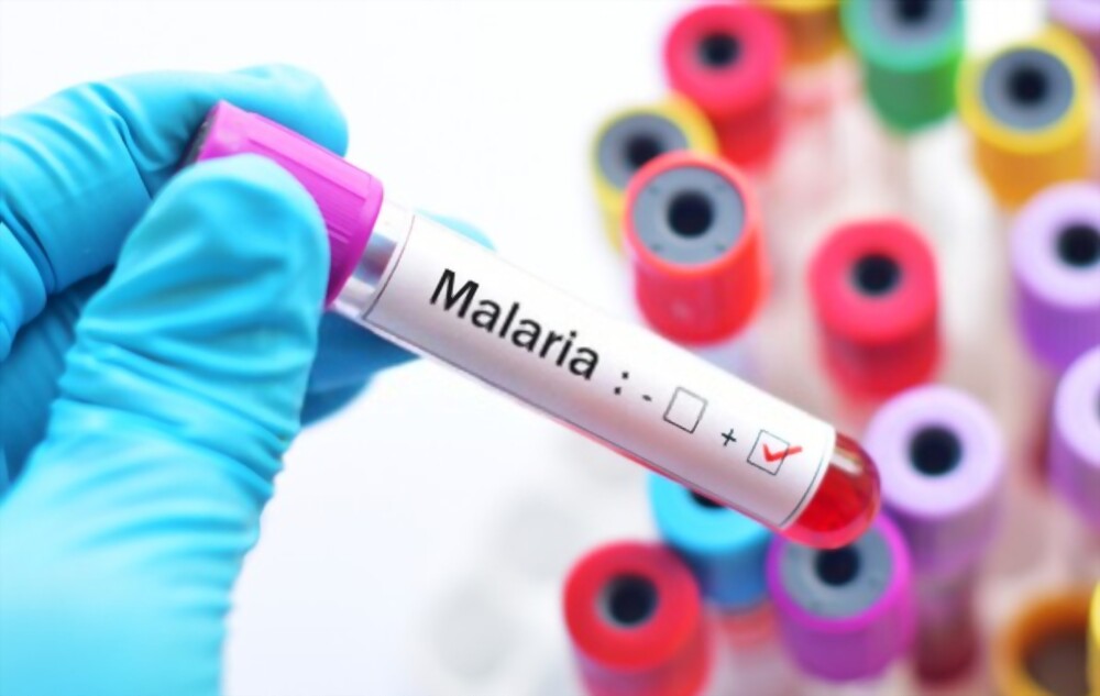 Abia PHCDA Boss Hails Discovery Of Malaria Vaccine