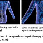 Spinal cord adaptation illustration