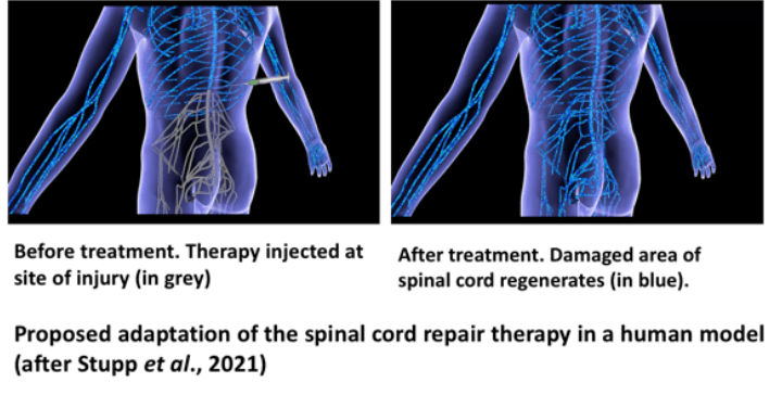 Spinal cord adaptation illustration