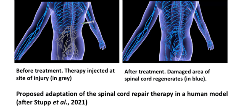 Spinal cord adaptation illustration