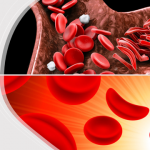 Gene Therapy Technology For Sickle-cell Disease Treatment