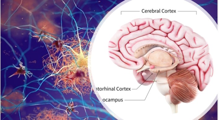 Emerging Drugs For Treatment Of Alzheimer’s Disease