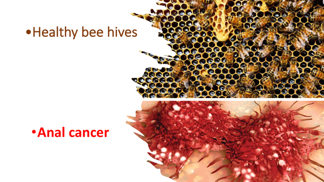Radiofrequency Surgery For Treatment Of Anal Cancer And A Vaccine First For Bees