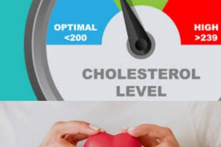 How To Manage High Cholesterol