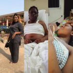 Nigerian Lady With Lupus Disease Gets N6.8m Lifeline, Needs N15m For Treatment