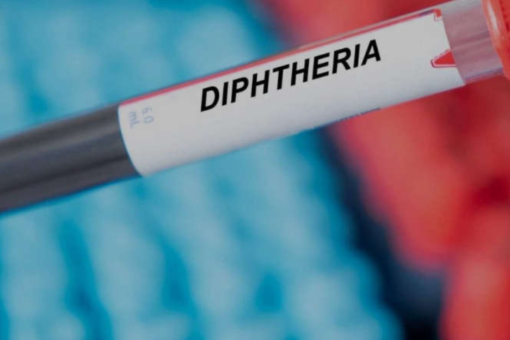 Diphtheria Spreads In More LGAs As Nigeria Records 7202 Cases, 453 Deaths