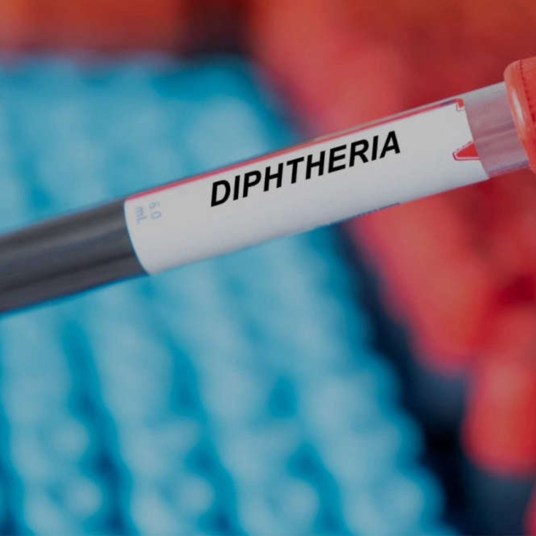 Diphtheria Spreads In More LGAs As Nigeria Records 7202 Cases, 453 Deaths