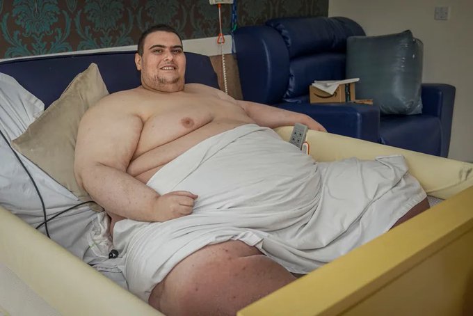 Britain’s Heaviest Man, Holton, Dies At 33