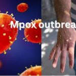 Africa CDC Officially Declares Mpox Public Health Emergency