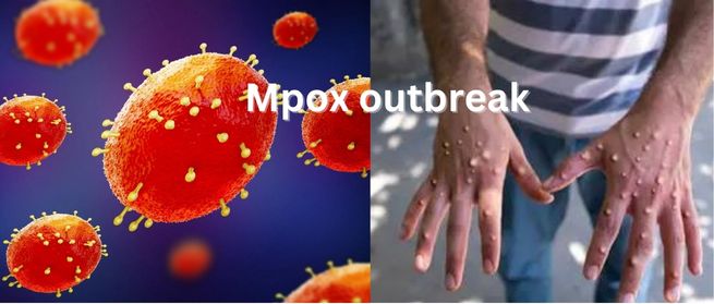 Africa CDC Officially Declares Mpox Public Health Emergency