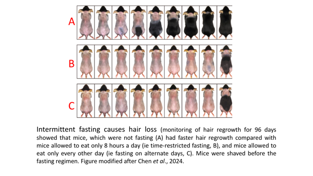 Fasting Causes Hair Loss 